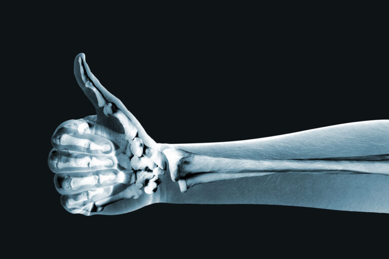 Nourishing your bones